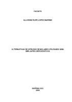 ALTERNATIVAS DE INTRUSÃO DE MOLARES UTILIZANDO MINIMPLANTES - Alisson.pdf